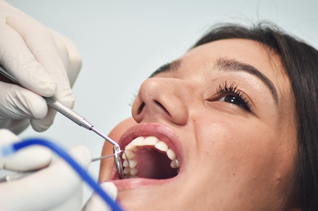 Implantologia dentale, riacquista oggi il sorriso